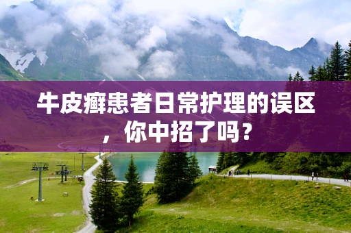 牛皮癣患者日常护理的误区，你中招了吗？