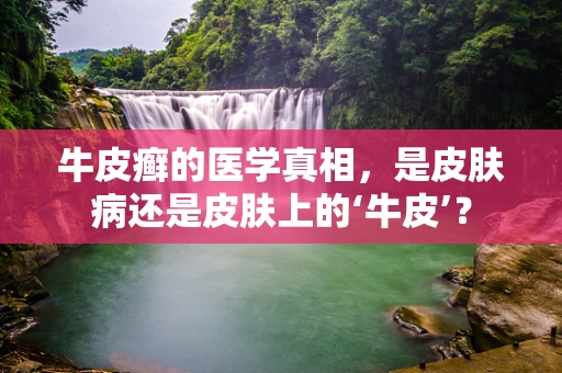 牛皮癣的医学真相，是皮肤病还是皮肤上的‘牛皮’？